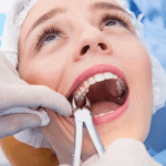 How Long Does Wisdom Teeth Removal Take – surgical procedure