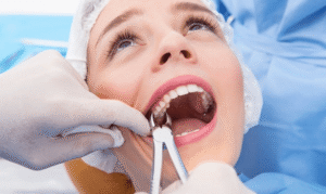 How Long Does Wisdom Teeth Removal Take – surgical procedure